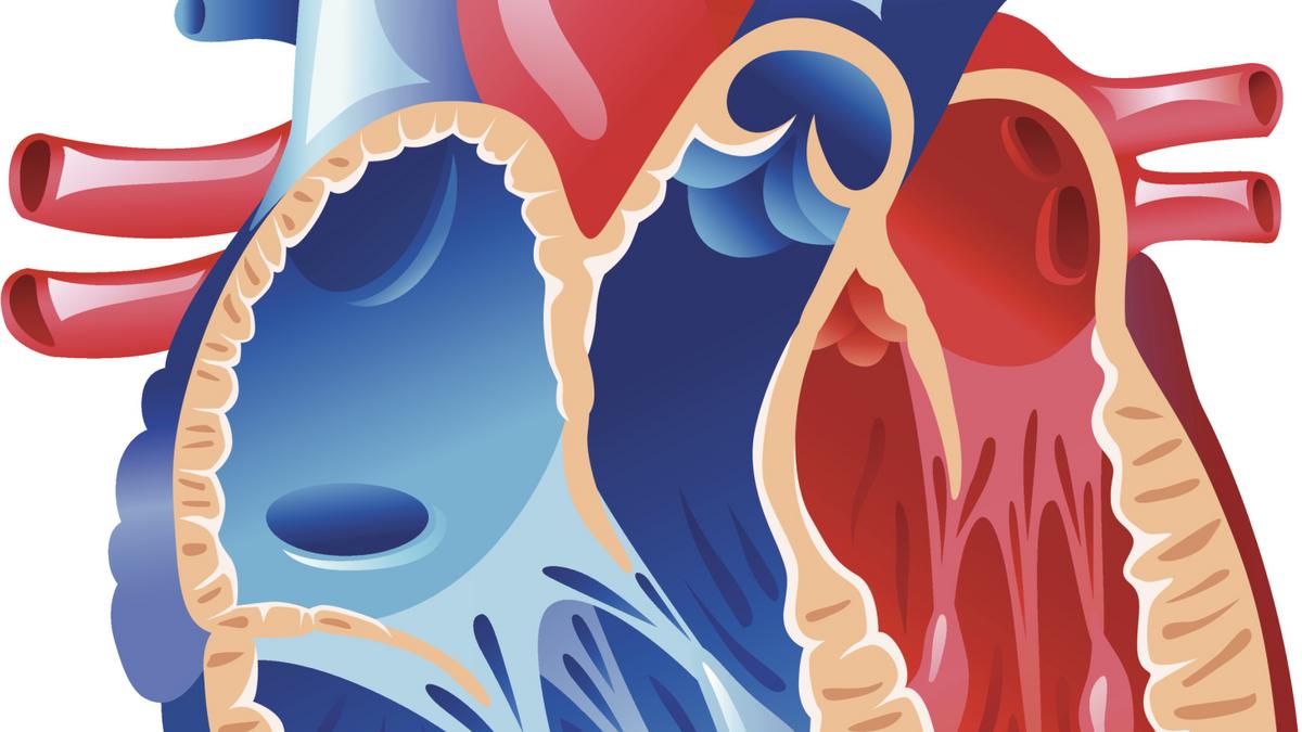 Medtronic Signs 458M Deal To Buy Twelve Inc s Leaky Heart Valve Fix