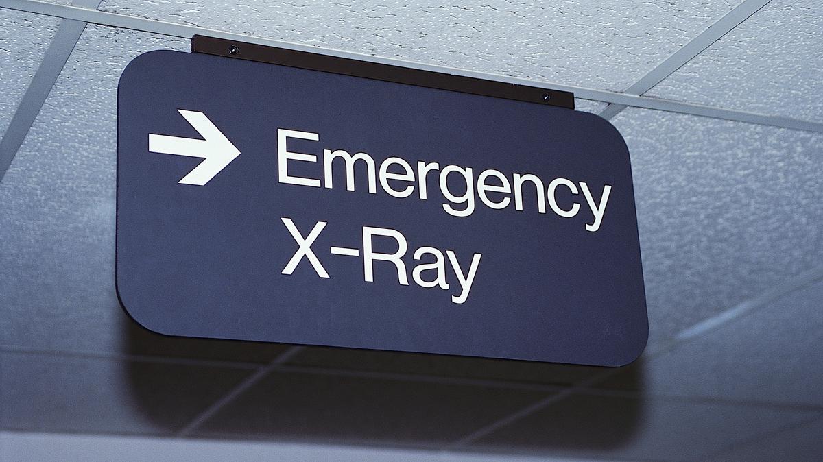 WNY hospitals score low to average in CMS star ratings Buffalo