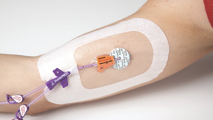 Maker of anchor-like medical device on the hunt for $7M