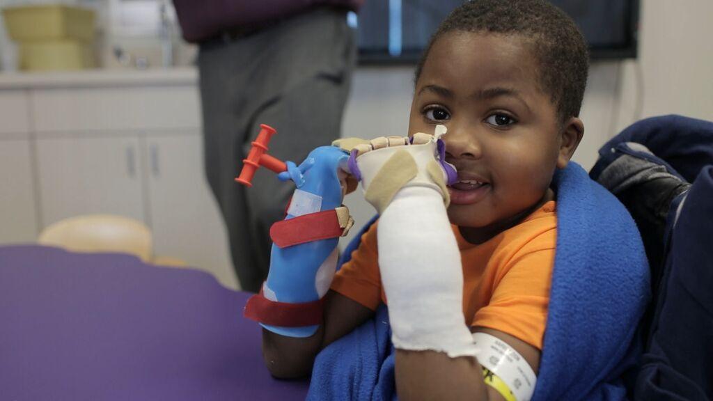 Zion Harvey, CHOP double hand transplant patient, returns home to