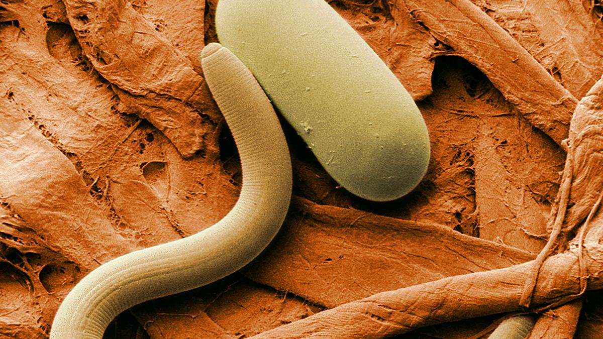 5 things to know today, and tiny worms are coming for you Sacramento