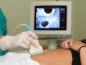 Pregnancy Ultrasound