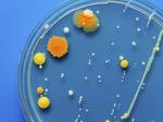 The Petri Dish: $150M IPO, new biotech fund and Alexion's patent case