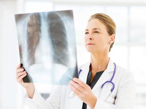 Female Doctor Examining X-Ray In Hospital