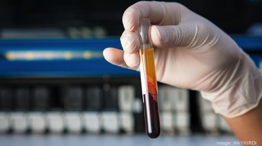 Blood tube at the microbiology laboratory