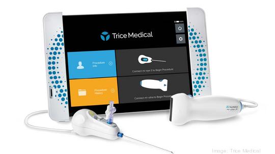 Trice Medical mi eye