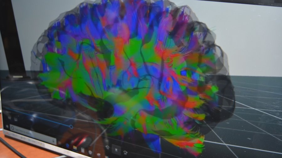 AdventHealth to use virtual reality tech to treat seizures Tampa Bay