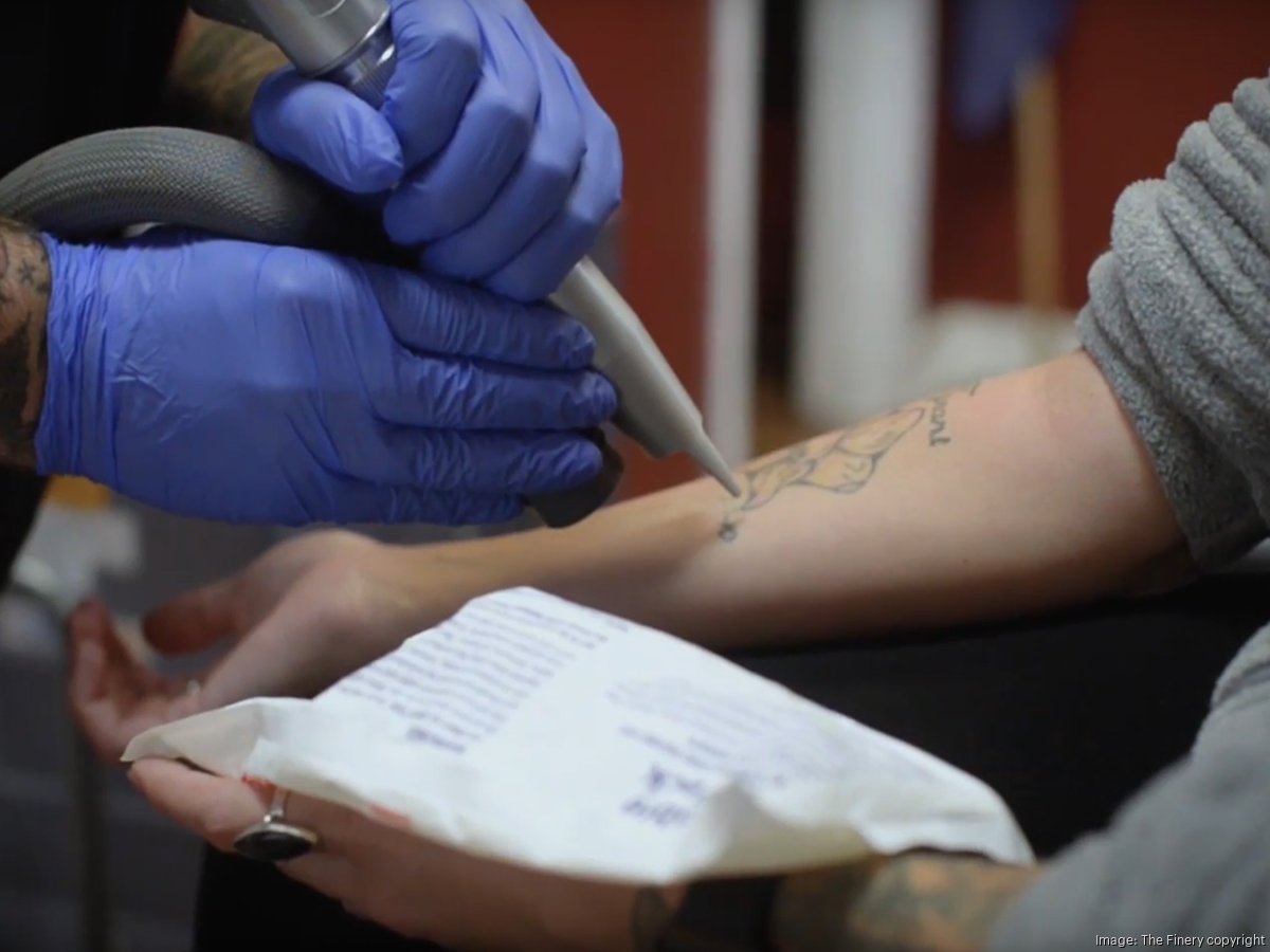 How Much Does Tattoo Removal Cost In Maine? - Coastal Aesthetics