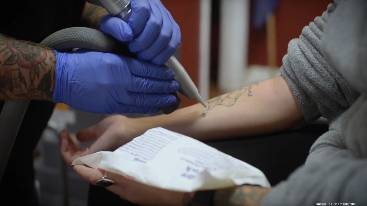 Laser Tattoo Removal in Albuquerque | Western Dermatology