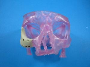 3D-Printed-Skull-Face