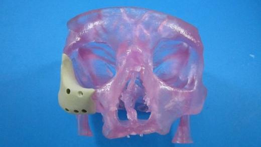 3D-Printed-Skull-Face