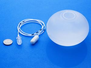 Intragastric Balloon