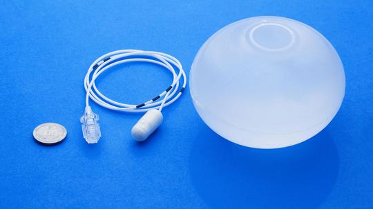 Intragastric Balloon