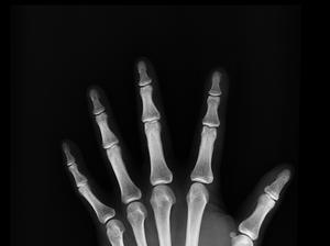 xray hand