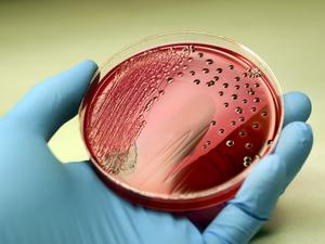 Salmonella colonies growing on XLD agar plate