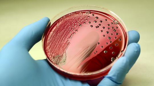 Salmonella colonies growing on XLD agar plate