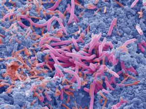 Tongue bacteria, SEM