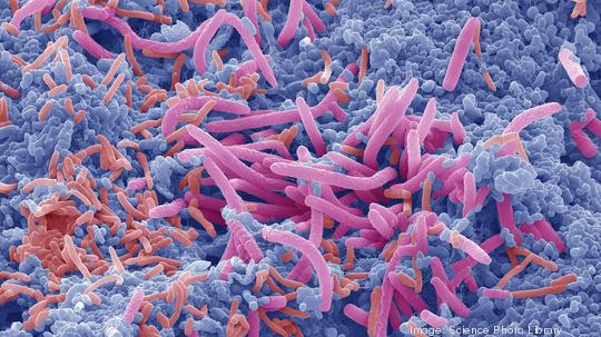 Tongue bacteria, SEM