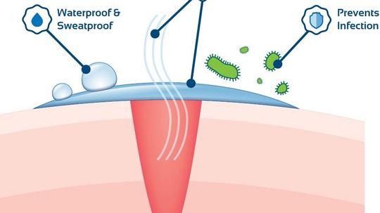 Hydroshield barrier over wound