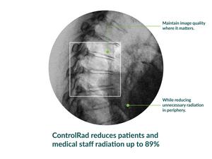 ControlRad-Trace-Benefits