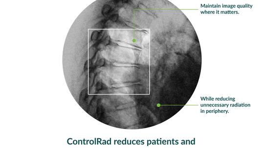 ControlRad-Trace-Benefits