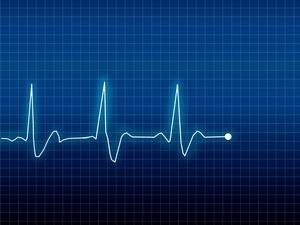 Digital Composite Image Of Pulse Trace On Grid