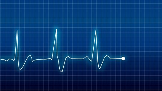 Digital Composite Image Of Pulse Trace On Grid