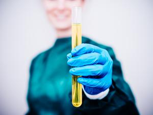 Laboratory technician holding a solution in a test tube.