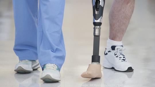 Nurse helping man walk with prosthetic leg