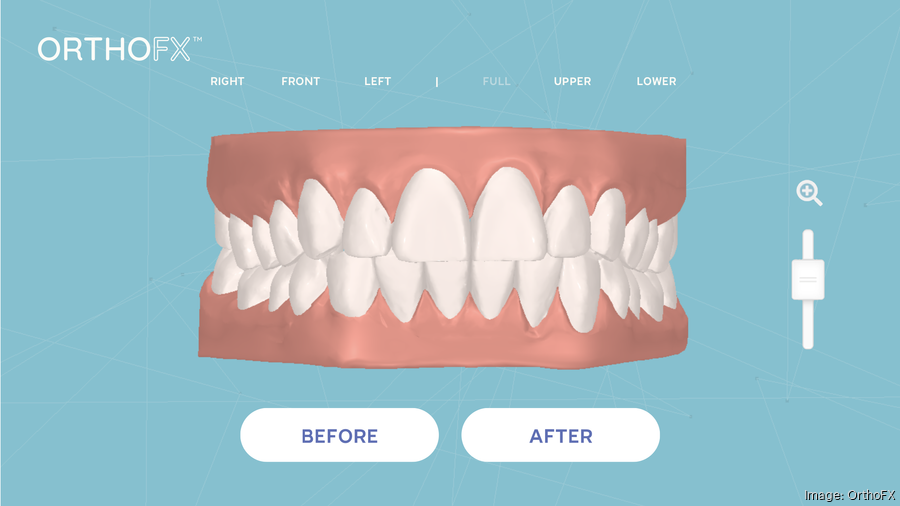 Teethstraightening startup OrthoFX aims to flip