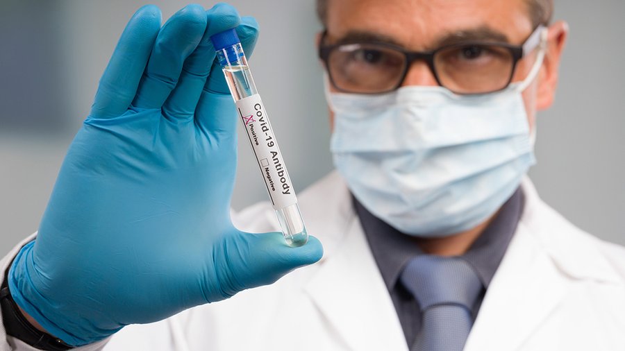 What you need to know about Covid19 antibody testing Buffalo Business First