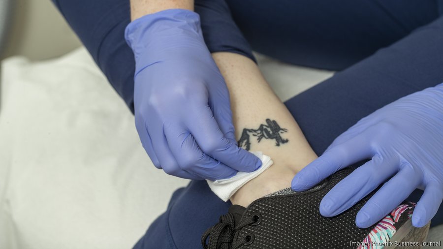 Laser technology makes tattoo removal easier faster  YouTube