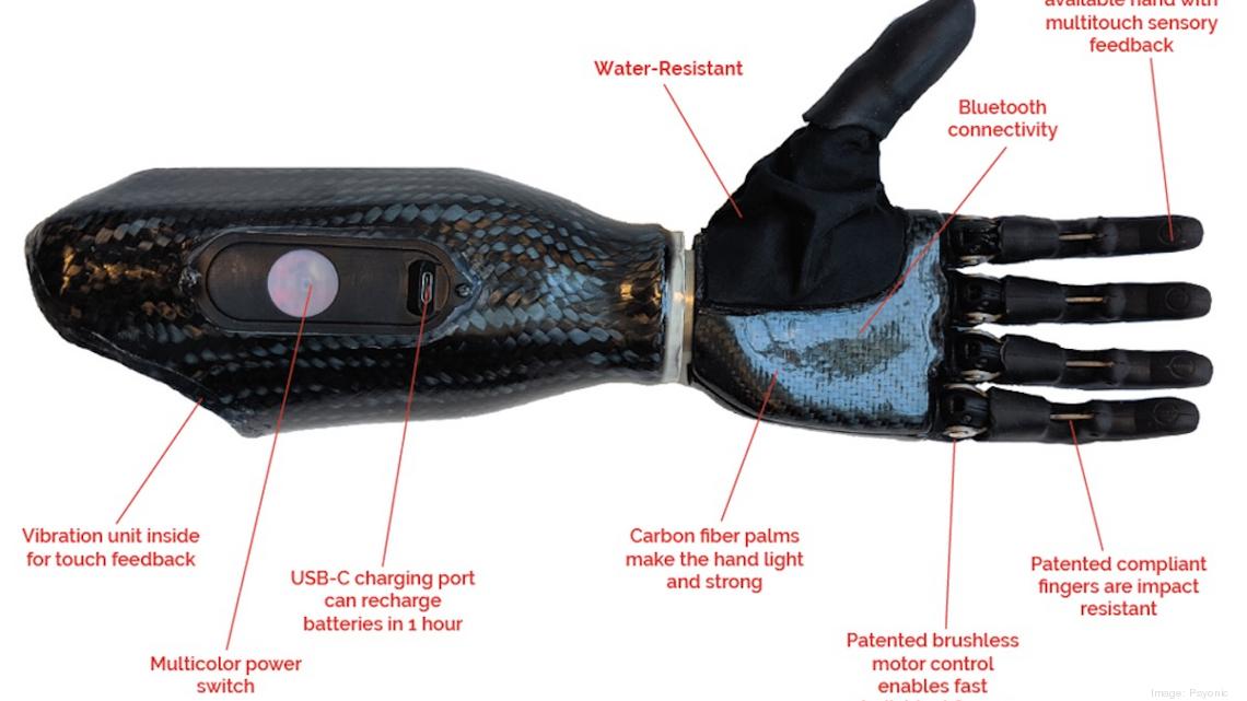 https://www.bizjournals.com/chicago/inno/stories/news/2021/09/02/pysonic-startup-building-a-bionic-hand.html