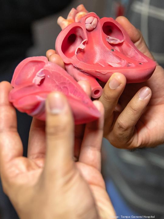 3D printed heart