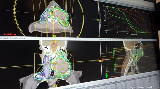 Cone Health radiation oncology treatment plan automation