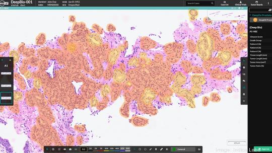 Indica Labs - DeepBio prostate algorithm results shown in the HALO AP platform