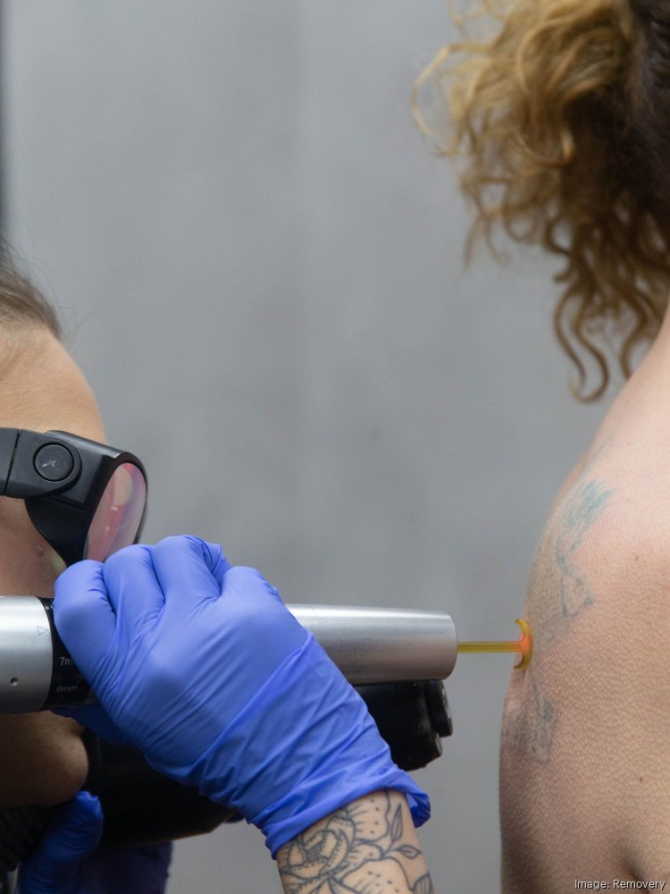 Removery, a laser tattoo removal clinic, to open flagship location - New  York Business Journal