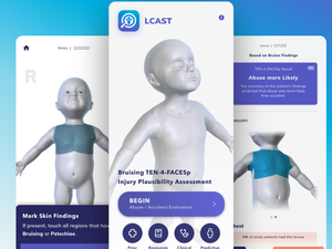 LCAST app