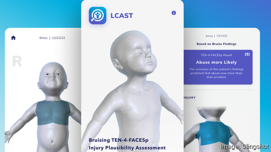 LCAST app