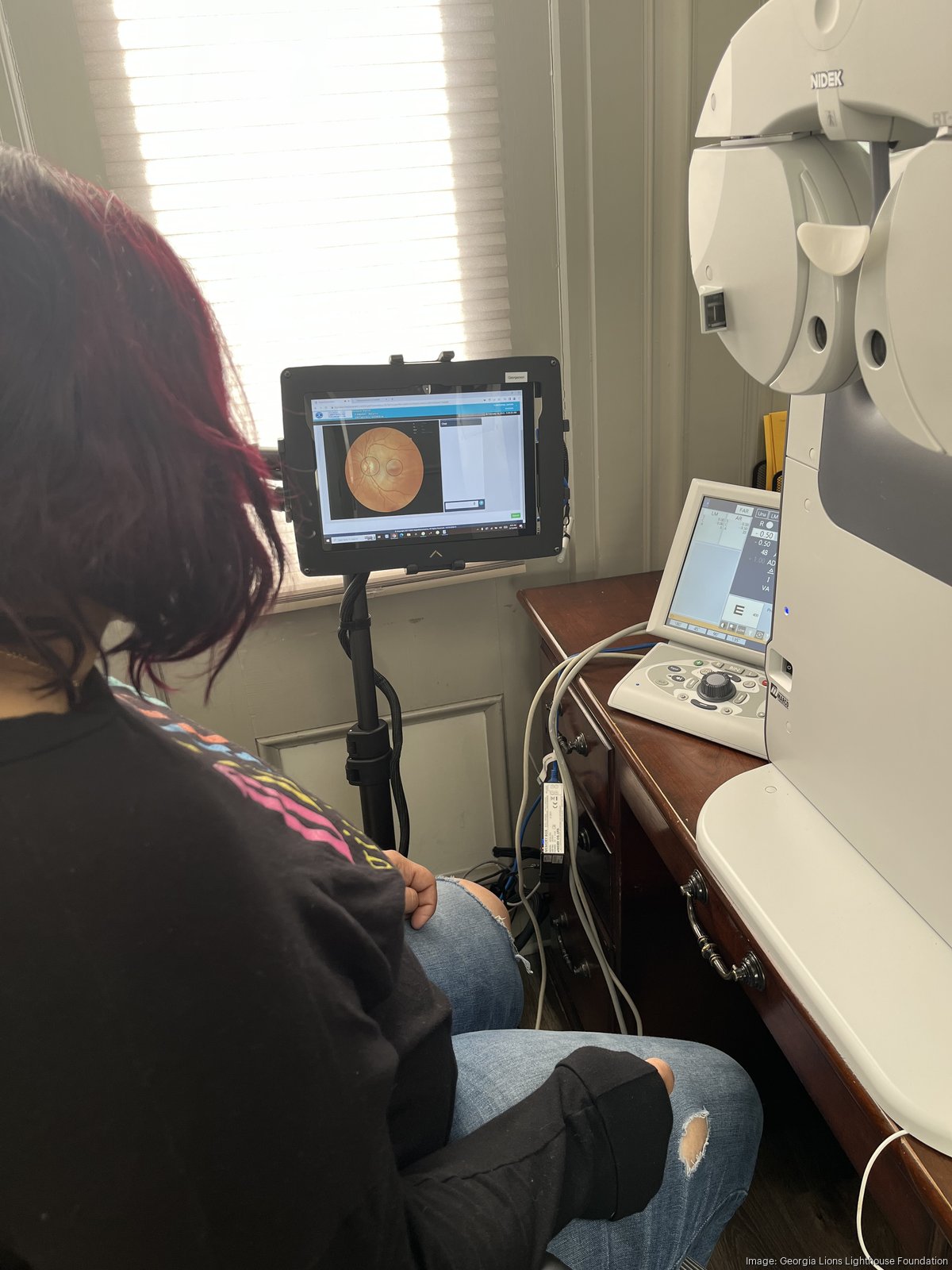 Remote Optometry Jobs - b6pzii4