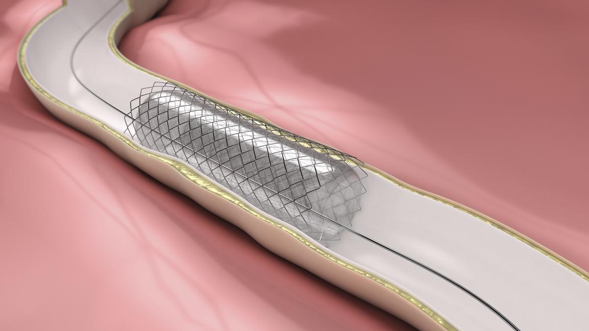 Medtronic, Boston Scientific stock drops as study finds heart stents