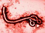 RNs, others raise concerns over Ebola preparedness, in wake of first U.S. case