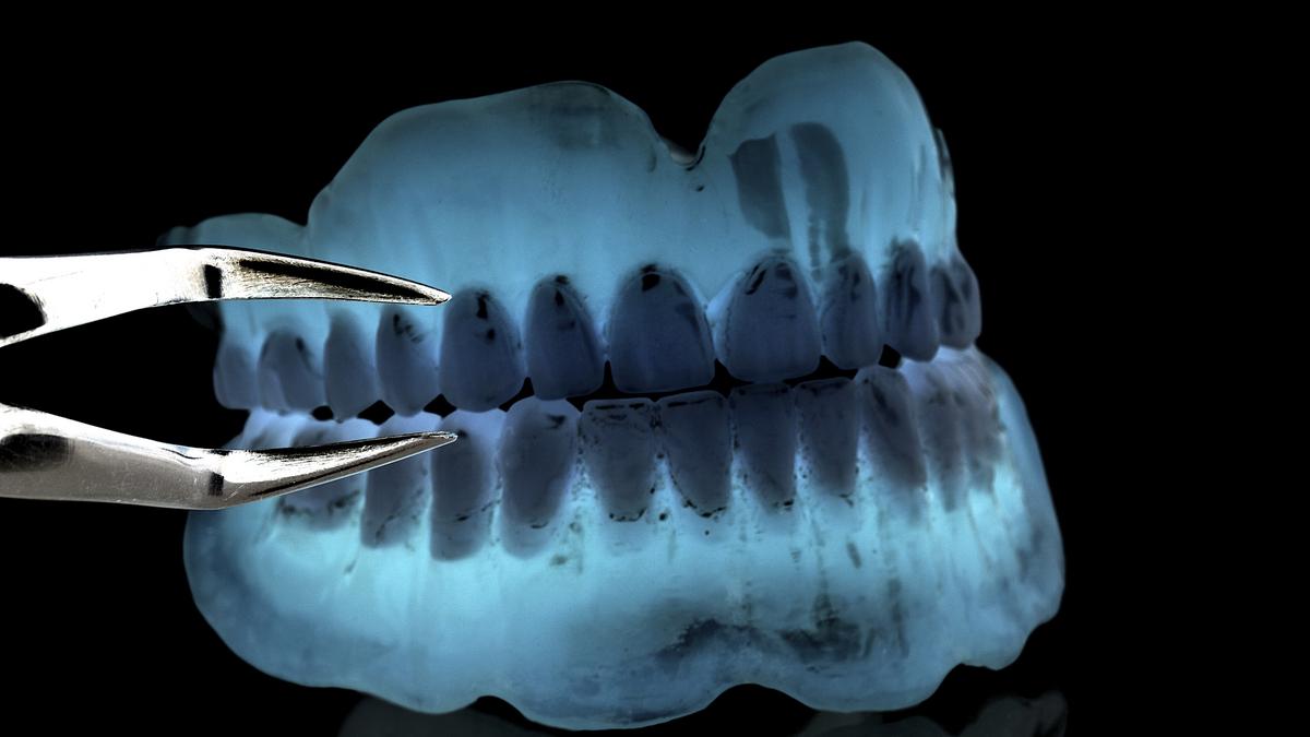 Dental Arts Laboratories in Olivette lays off 33 St