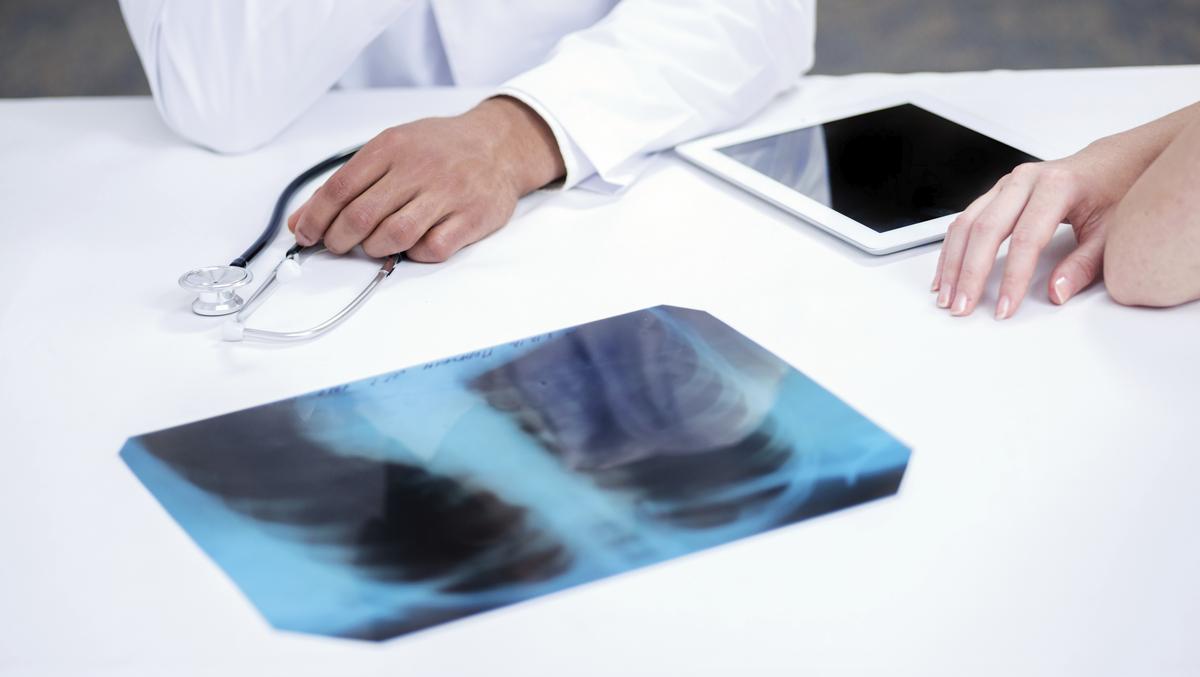 Medical device maker Pulmonx boosts IPO targets by 69 percent Silicon