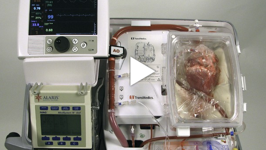 Heart Box Example Biomed Heart in a box